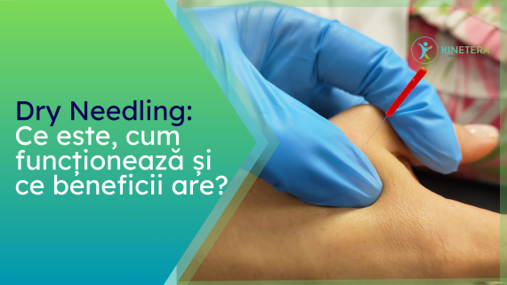Dry needling Kinetera Iasi